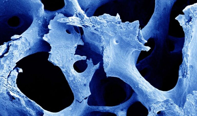 داربست های استخوان بیوپیزوالکتریک پرینت سه بعدی/ چهار بعدی